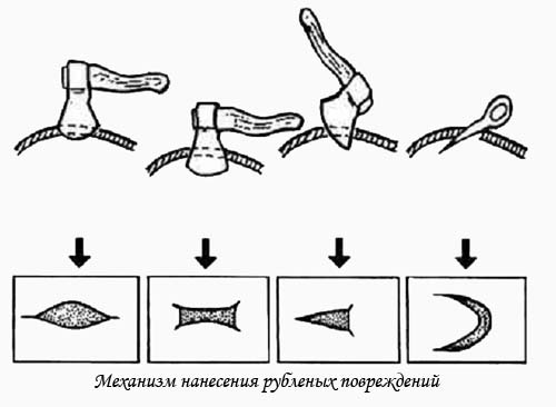 Механизм нанесения рубленых повреждений Механизм нанесения рубленых повреждений